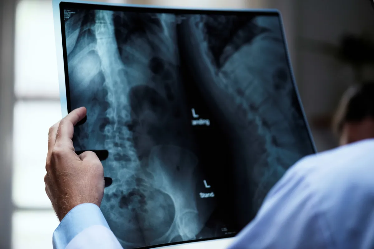 Clinician reviewing an orthopedic scan